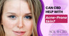 Can CBD Help with Acne-Prone Skin? - SOL✿CBD