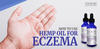 The Truth About Hemp Oil For Eczema - SOL✿CBD